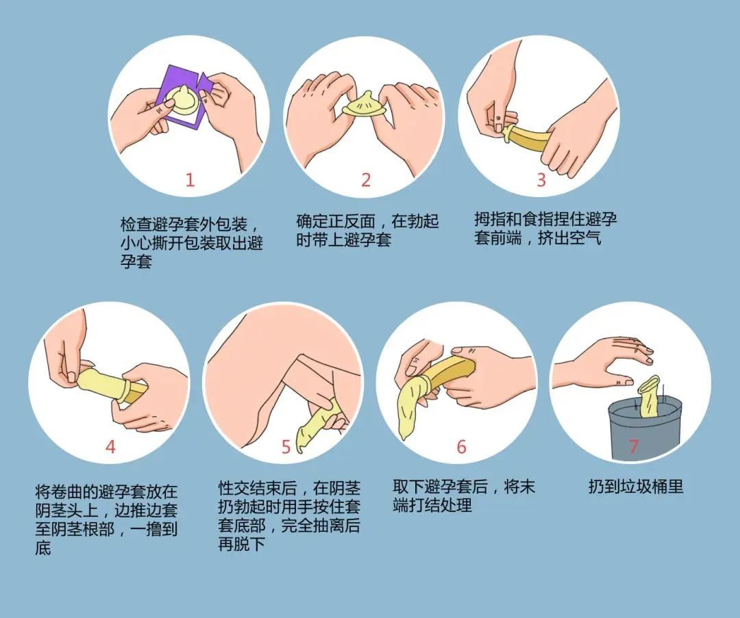 年輕人成艾滋病重災區，正確戴套很有必要.jpg